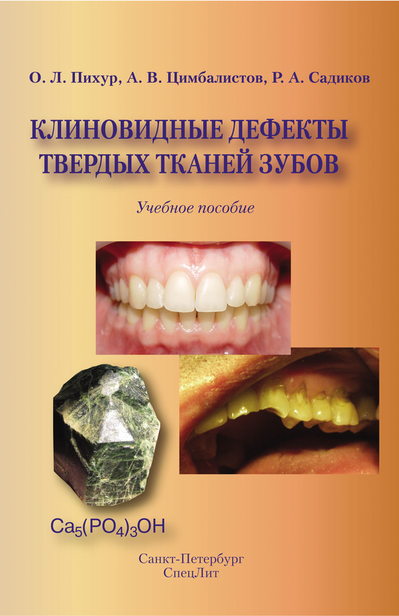 Скачать Клиновидные дефекты твердых тканей зубов быстро